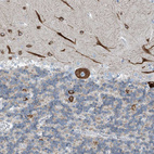 Immunohistochemical staining of human cerebellum shows strong cytoplasmic positivity in Purkinje cells.