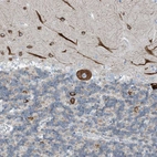 Immunohistochemical staining of human cerebellum shows strong cytoplasmic positivity in Purkinje cells.