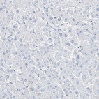 Immunohistochemical staining of human liver shows no positivity in hepatocytes as expected.