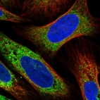 Immunofluorescent staining of human cell line U-2 OS shows localization to endoplasmic reticulum.