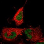 Anti-ABTB2 Antibody