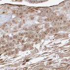 Anti-ZGRF1 Antibody
