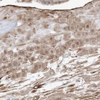 Anti-ZGRF1 Antibody