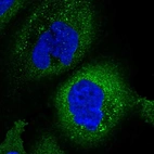 Immunofluorescent staining of human cell line A-431 shows localization to cytosol.