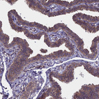 Anti-NAA10 Antibody