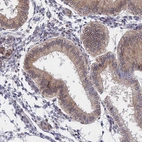 Immunohistochemical staining of human endometrium shows weak to moderate cytoplasmic positivity in glandular cells.