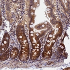 Immunohistochemical staining of human duodenum shows moderate to strong cytoplasmic positivity in glandular cells.