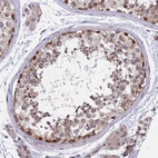 Immunohistochemical staining of human testis shows weak to moderate cytoplasmic positivity in cells in seminiferous ducts.