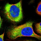 Immunofluorescent staining of human cell line U-2 OS shows localization to cytosol.