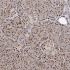 Anti-PMM1 Antibody