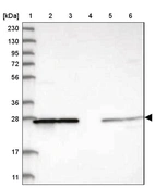 Lane 1: Marker [kDa] 230, 130, 95, 72, 56, 36, 28, 17, 11_br/_Lane 2: Human cell line RT-4_br/_Lane 3: Human cell line U-251MG sp_br/_Lane 4: Human plasma (IgG/HSA depleted)_br/_Lane 5: Human liver tissue_br/_Lane 6: Human tonsil tissue