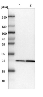 Lane 1: NIH-3T3 cell lysate (Mouse embryonic fibroblast cells)_br/_Lane 2: NBT-II cell lysate (Rat Wistar bladder tumour cells)