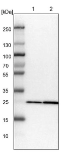 Lane 1: NIH-3T3 cell lysate (Mouse embryonic fibroblast cells)_br/_Lane 2: NBT-II cell lysate (Rat Wistar bladder tumour cells)
