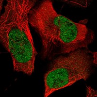Anti-FOSL1 Antibody