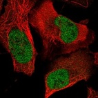 Anti-FOSL1 Antibody