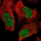 Anti-FOSL1 Antibody