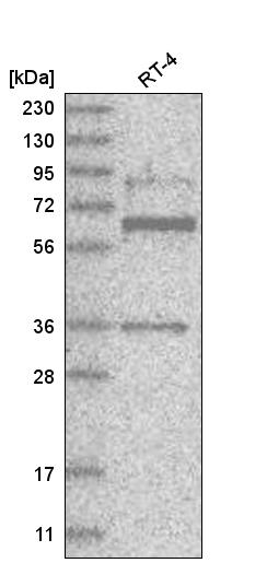 Anti-ZNF667 Antibody
