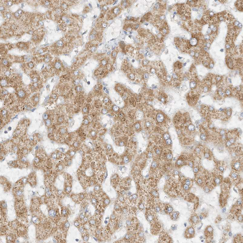 Anti-STT3A Antibody