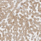 Anti-STT3A Antibody
