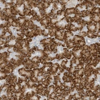 Immunohistochemical staining of human pancreas shows strong granular cytoplasmic positivity in exocrine glandular cells.
