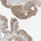 Immunohistochemical staining of human fallopian tube shows moderate granular cytoplasmic positivity in glandular cells.