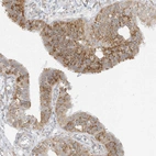 Immunohistochemical staining of human fallopian tube shows moderate granular cytoplasmic positivity in glandular cells.