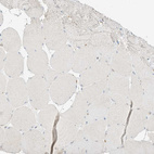 Immunohistochemical staining of human skeletal muscle shows no positivity in myocytes as expected.