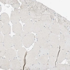 Immunohistochemical staining of human skeletal muscle shows no positivity in myocytes as expected.