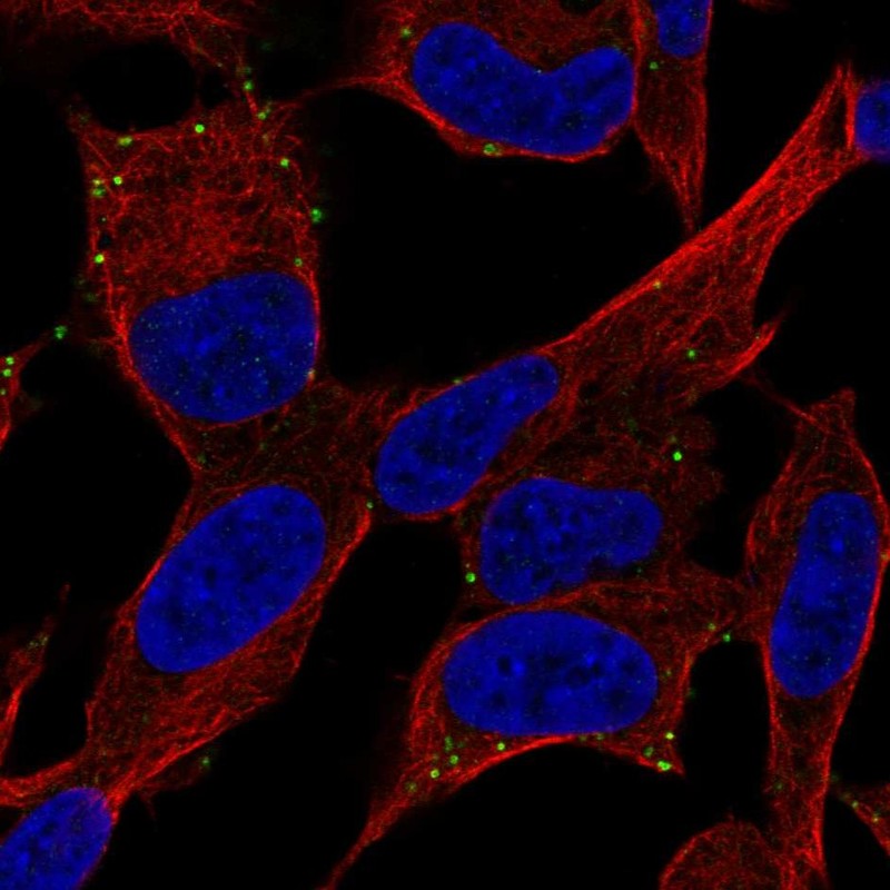 Anti-ADCYAP1R1 Antibody