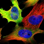 Immunofluorescent staining of human cell line U-251 MG shows localization to cytosol.