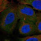 Anti-ARHGEF40 Antibody