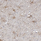 Anti-ARHGEF40 Antibody
