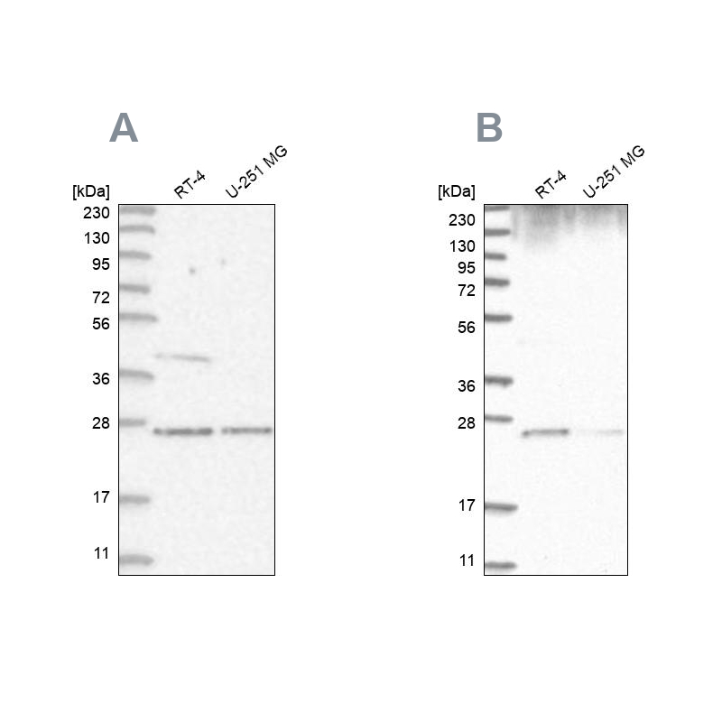 Anti-GRB2 Antibody