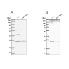 Anti-GRB2 Antibody
