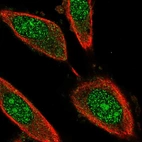 Immunofluorescent staining of human cell line PC-3 shows localization to nucleus & nucleoli.
