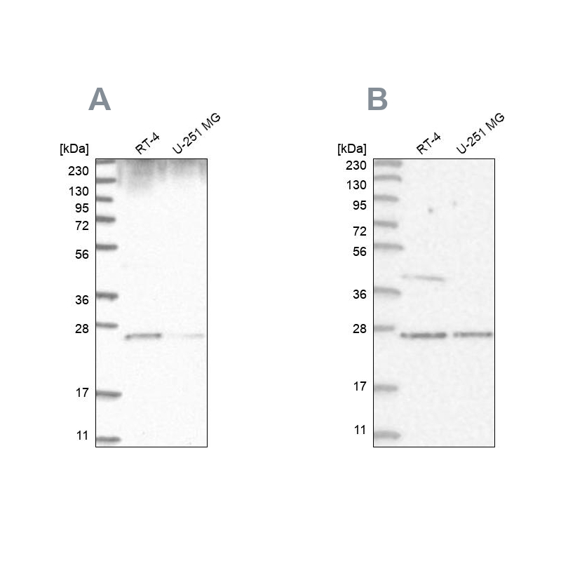Anti-GRB2 Antibody