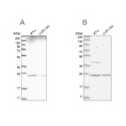 Anti-GRB2 Antibody