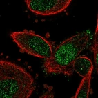 Immunofluorescent staining of human cell line PC-3 shows localization to nucleoplasm.