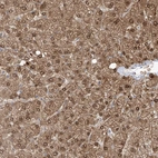 Anti-OGT Antibody