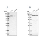 Western blot analysis using Anti-OGT antibody HPA030751 (A) shows similar pattern to independent antibody HPA030753 (B).