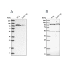 Western blot analysis using Anti-OGT antibody HPA030751 (A) shows similar pattern to independent antibody HPA030753 (B).