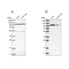 Anti-OGT Antibody