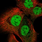 Immunofluorescent staining of human cell line A-431 shows localization to nucleoplasm.