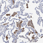 Anti-OGT Antibody