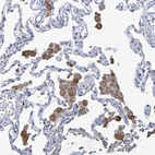 Immunohistochemical staining of human lung shows moderate granular cytoplasmic positivity in macrophages.