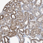 Immunohistochemical staining of human kidney shows moderate granular cytoplasmic positivity in cells in tubules.