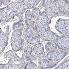 Anti-OGT Antibody