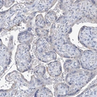 Immunohistochemical staining of human placenta shows very weak positivity in trophoblastic cells as expected.