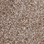 Immunohistochemical staining of human tonsil shows strong nuclear positivity in non-germinal center cells.