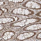 Immunohistochemical staining of human rectum shows strong nuclear positivity in glandular cells.